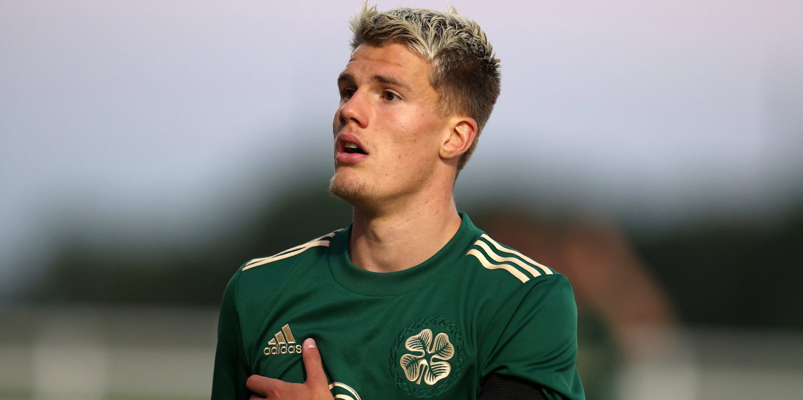 Bristol City v Celtic - Pre-Season Friendly